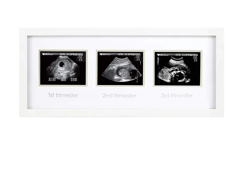 Pearhead White Triple Sonogram Keepsake Frame For Pregnancy Memories 2